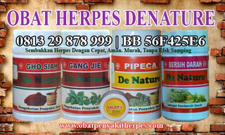 Illustration for article titled Cara Pengobatan Penyakit Herpes